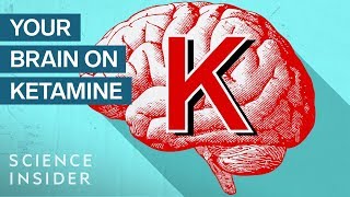 What is Ketamine Therapy?